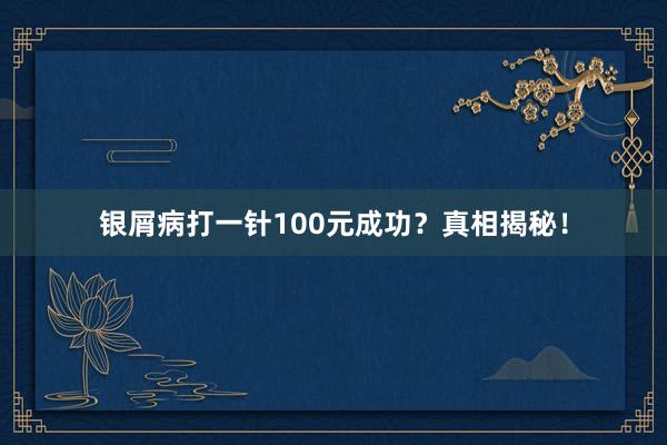 银屑病打一针100元成功？真相揭秘！
